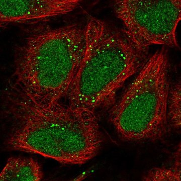 抗-EXOC6 兔抗 Prestige Antibodies&#174; Powered by Atlas Antibodies, affinity isolated antibody