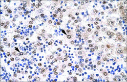 Anti-IRF8 antibody produced in rabbit affinity isolated antibody