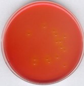 GranuCult® prime Salmonella Shigella (SS) Agar ISO 6579