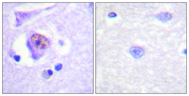 Anti-SOX9 antibody produced in rabbit affinity isolated antibody