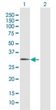 Anti-FBXO44 antibody produced in rabbit purified immunoglobulin, buffered aqueous solution