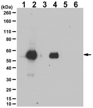 Anti-phospho-Keratin-8 Antibody (Ser23) from rabbit, purified by affinity chromatography