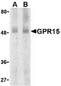 Anti-GPR15 antibody produced in rabbit affinity isolated antibody
