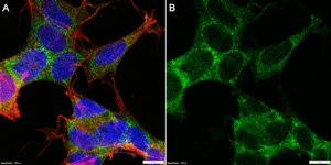 Anti-MEX3A Antibody, clone 1J23 ZooMAb® Rabbit Monoclonal recombinant, expressed in HEK 293 cells