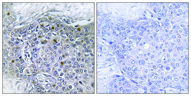 Anti-ZMY11 antibody produced in rabbit affinity isolated antibody