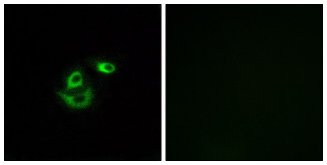 Anti-CLCC1 antibody produced in rabbit affinity isolated antibody