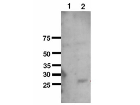 Anti-SOD2 Antibody serum, Chemicon&#174;