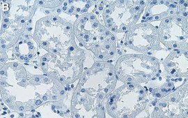 Anti-MBD3 Antibody, clone 1K19 ZooMAb® Rabbit Monoclonal recombinant, expressed in HEK 293 cells