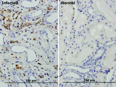 Monoclonal Anti-BKV VP1 antibody produced in mouse clone 3B2, purified immunoglobulin