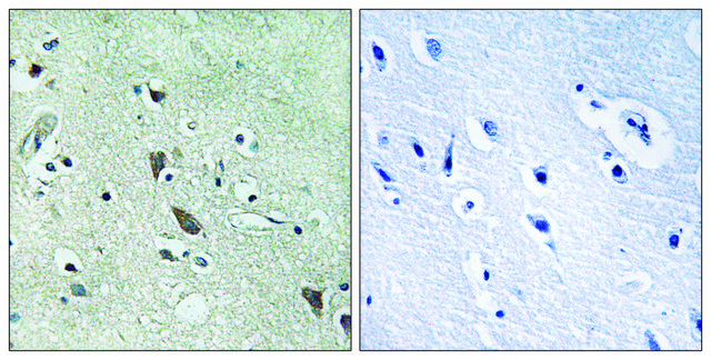 Anti-HTRA2 antibody produced in rabbit affinity isolated antibody