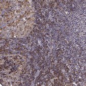 Anti-DOK2 Prestige Antibodies® Powered by Atlas Antibodies, affinity isolated antibody