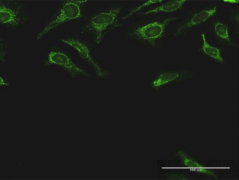 Anti-DLST antibody produced in rabbit purified immunoglobulin, buffered aqueous solution