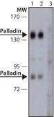 Anti-Palladin antibody produced in rabbit ~1.0 mg/mL, affinity isolated antibody, buffered aqueous solution