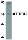 Anti-TREX2 antibody produced in rabbit affinity isolated antibody, buffered aqueous solution