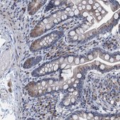 Anti-C20orf196 antibody produced in rabbit Prestige Antibodies® Powered by Atlas Antibodies, affinity isolated antibody, buffered aqueous glycerol solution