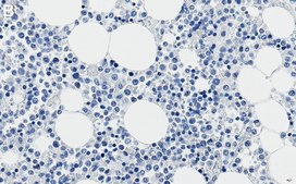 Anti-CD11b Antibody, clone 2K14 ZooMAb® Rabbit Monoclonal recombinant, expressed in HEK 293 cells