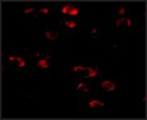 Anti-TMEM18 antibody produced in rabbit affinity isolated antibody, buffered aqueous solution