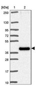 Anti-TMEM184C antibody produced in rabbit Prestige Antibodies® Powered by Atlas Antibodies, affinity isolated antibody, buffered aqueous glycerol solution