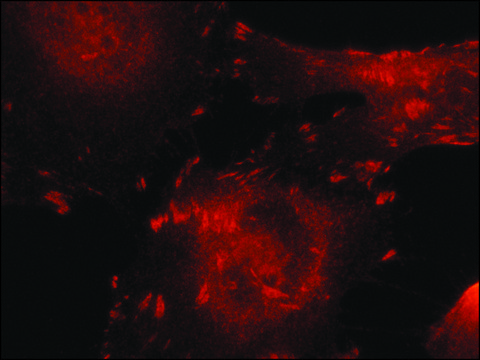 Anti-Talin antibody,Mouse monoclonal clone TA205, purified from hybridoma cell culture