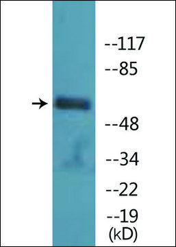 Anti-phospho-PAK1 (pSer199) antibody produced in rabbit affinity isolated antibody