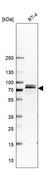 Anti-JUP antibody produced in rabbit Prestige Antibodies® Powered by Atlas Antibodies, affinity isolated antibody, buffered aqueous glycerol solution