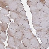 Anti-FJX1 antibody produced in rabbit Prestige Antibodies® Powered by Atlas Antibodies, affinity isolated antibody, buffered aqueous glycerol solution