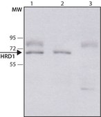 Anti-HRD1/SYVN1 antibody produced in rabbit ~1.0 mg/mL, affinity isolated antibody, buffered aqueous solution