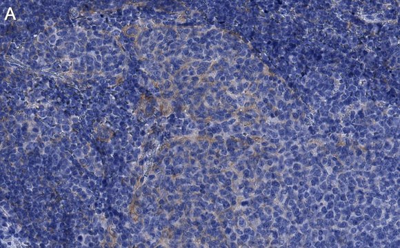 Anti-JAK2 Antibody, clone 1L13 ZooMAb&#174; Rabbit Monoclonal recombinant, expressed in HEK 293 cells