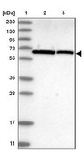 Anti-UBXN4 antibody produced in rabbit Prestige Antibodies® Powered by Atlas Antibodies, affinity isolated antibody, buffered aqueous glycerol solution
