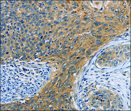 Anti-ORMDL3 antibody produced in rabbit affinity isolated antibody