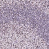 Anti-TLE3 antibody produced in rabbit Prestige Antibodies® Powered by Atlas Antibodies, affinity isolated antibody, buffered aqueous glycerol solution