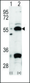 Anti-PDX1 (N-term) antibody produced in rabbit IgG fraction of antiserum, buffered aqueous solution