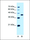 Anti-SLC14A1 antibody produced in rabbit affinity isolated antibody