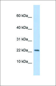 Anti-P2RX7 antibody produced in rabbit affinity isolated antibody