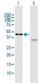 Anti-SIRT7 antibody produced in rabbit purified immunoglobulin, buffered aqueous solution