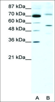 Anti-SIRT3 antibody produced in rabbit IgG fraction of antiserum