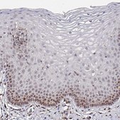 Anti-PRRX1 antibody produced in rabbit Prestige Antibodies® Powered by Atlas Antibodies, affinity isolated antibody, buffered aqueous glycerol solution