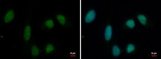 Monoclonal Anti-PRMT1 antibody produced in mouse clone GT779, affinity isolated antibody