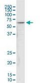 Monoclonal Anti-NDUFV1 antibody produced in mouse clone 4A7, purified immunoglobulin, buffered aqueous solution