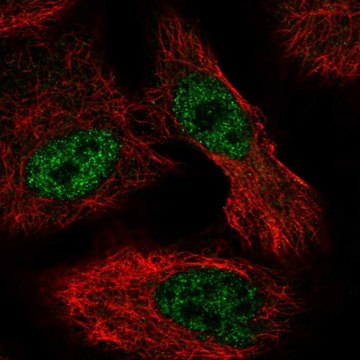 Anti-ALKBH6 antibody produced in rabbit Prestige Antibodies&#174; Powered by Atlas Antibodies, affinity isolated antibody