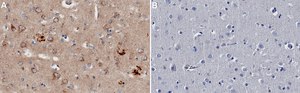 Anti-APP A4 Antibody, clone 22C11 ZooMAb® Mouse Monoclonal recombinant, expressed in HEK 293 cells