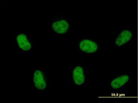 Anti-ZCCHC8 antibody produced in mouse purified immunoglobulin, buffered aqueous solution