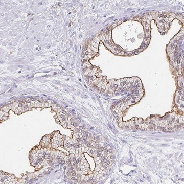 Anti-TAS1R3 antibody produced in rabbit Prestige Antibodies&#174; Powered by Atlas Antibodies, affinity isolated antibody, buffered aqueous glycerol solution