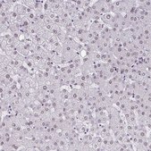 Anti-CBFA2T2 antibody produced in rabbit Prestige Antibodies® Powered by Atlas Antibodies, affinity isolated antibody, buffered aqueous glycerol solution