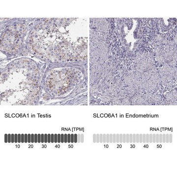 Anti-SLCO6A1 antibody produced in rabbit Prestige Antibodies&#174; Powered by Atlas Antibodies, affinity isolated antibody, buffered aqueous glycerol solution