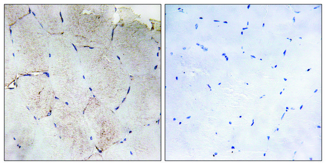 Anti-Collagen XII &#945;1 antibody produced in rabbit affinity isolated antibody