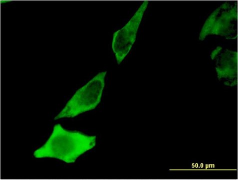 抗-BDNF单克隆抗体 小鼠抗 clone 1B10, purified immunoglobulin, buffered aqueous solution