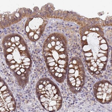 Anti-GSTM1 antibody produced in rabbit Prestige Antibodies&#174; Powered by Atlas Antibodies, affinity isolated antibody, buffered aqueous glycerol solution