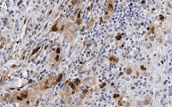 Anti-p-Rb-Ser807/811 Antibody, clone 3J7 ZooMAb&#174; Rabbit Monoclonal recombinant, expressed in HEK 293 cells