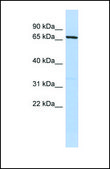 Anti-PRDM1 antibody produced in rabbit affinity isolated antibody